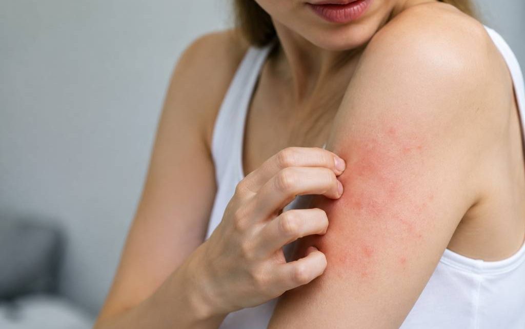 Allergie cutanée : causes, symptômes et solutions efficaces