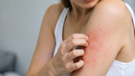 Allergie cutanée : causes, symptômes et solutions efficaces