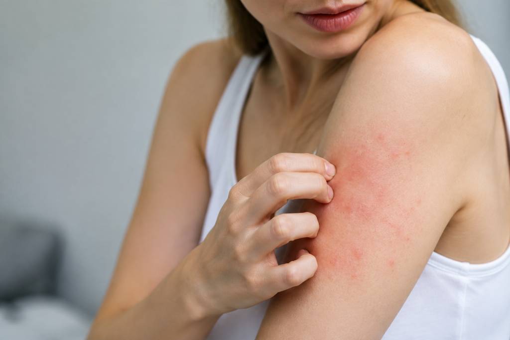 Allergie cutanée : causes, symptômes et solutions efficaces
